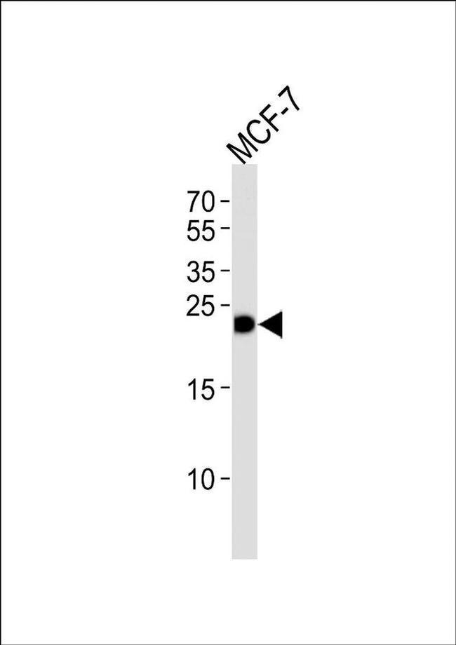 GSTM4 Antibody in Western Blot (WB)