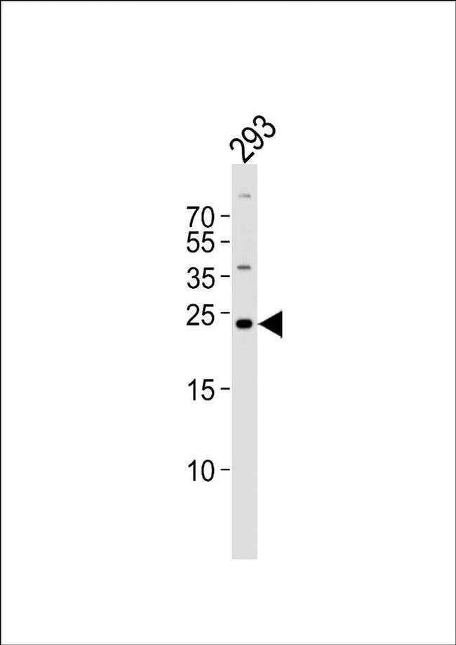 GADD45GIP1 Antibody in Western Blot (WB)