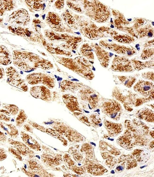 ZNF175 Antibody in Immunohistochemistry (Paraffin) (IHC (P))