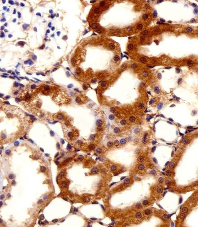 FBXL17 Isoform 2 Antibody in Immunohistochemistry (Paraffin) (IHC (P))