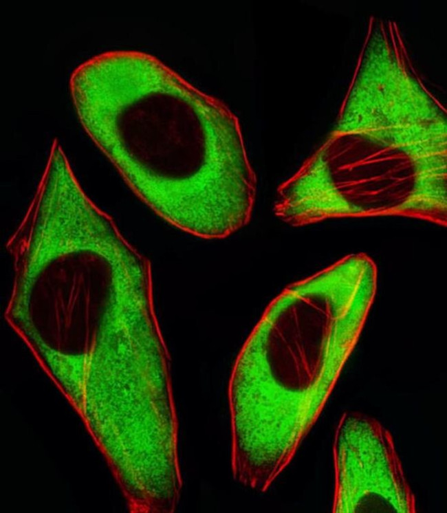 RPL6 Antibody in Immunocytochemistry (ICC/IF)