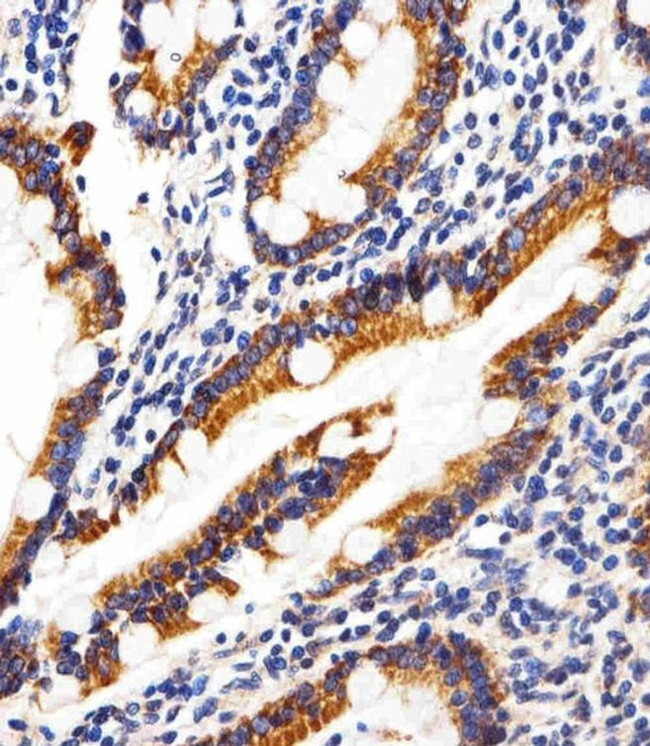 SHB Antibody in Immunohistochemistry (Paraffin) (IHC (P))