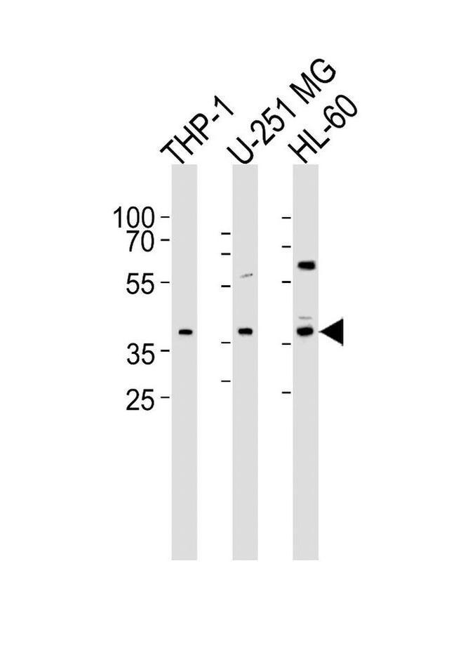 RAD9B Antibody in Western Blot (WB)