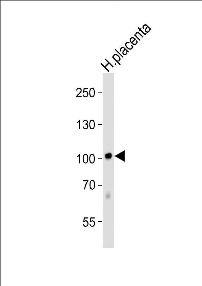 LEPRE1 Antibody in Western Blot (WB)