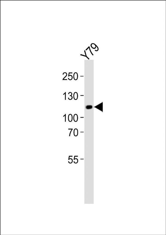 ANKRD24 Antibody in Western Blot (WB)