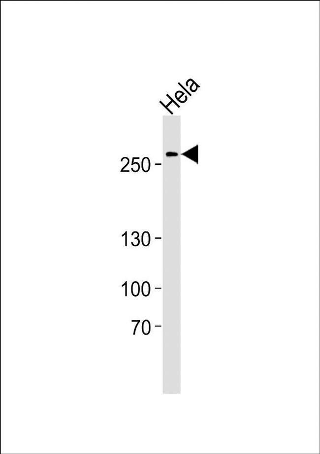AHCTF1 Antibody in Western Blot (WB)