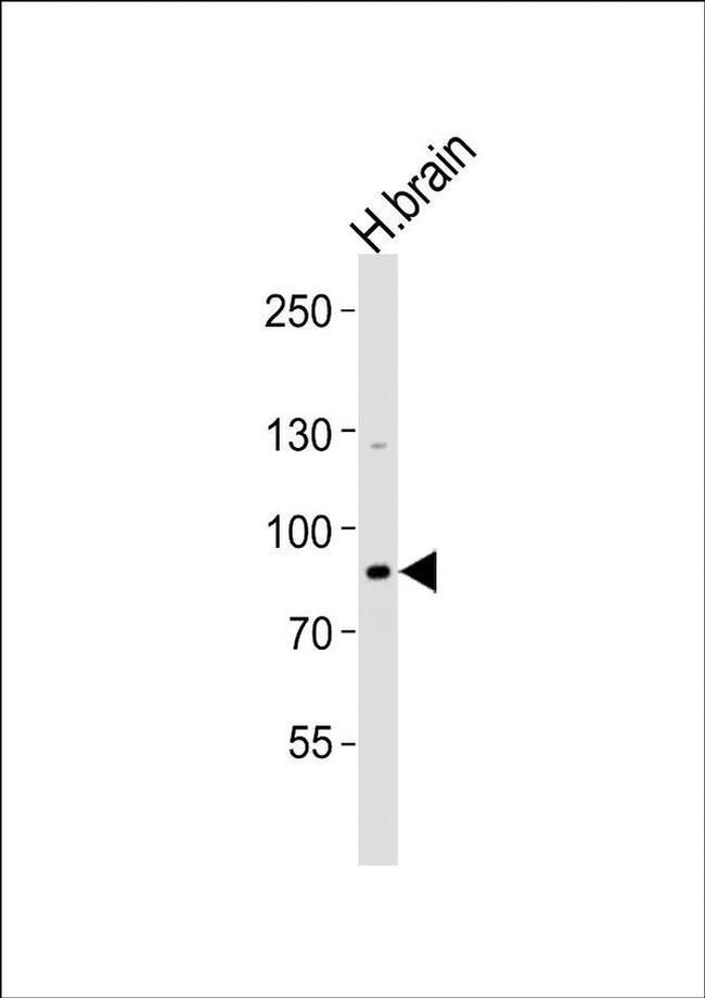 ANKRD20A8P Antibody in Western Blot (WB)