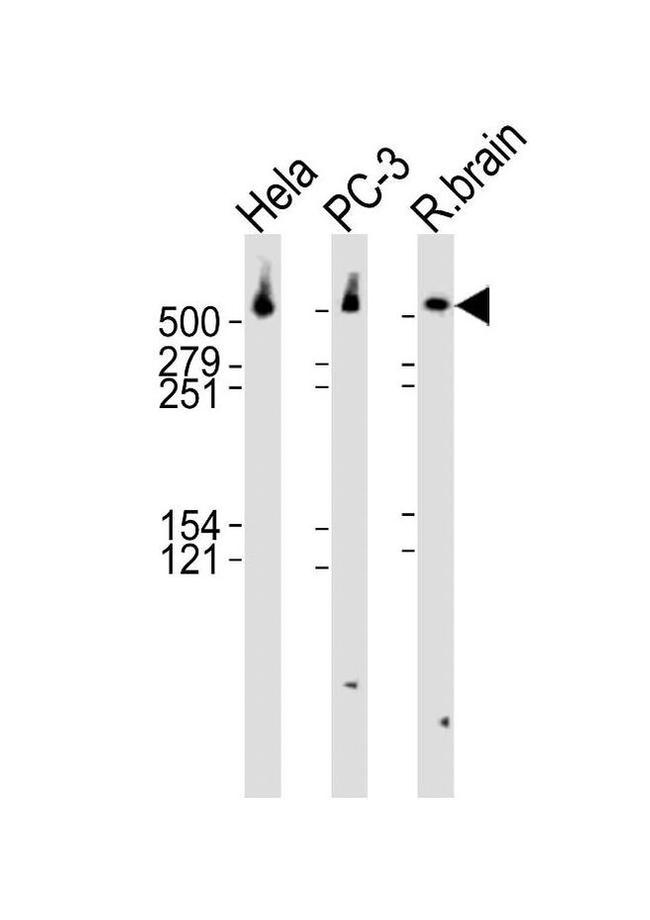 DYNC1H1 Antibody in Western Blot (WB)