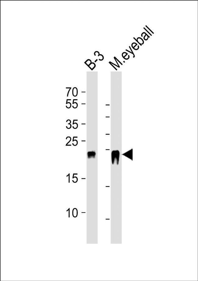 CRYBB2 Antibody in Western Blot (WB)