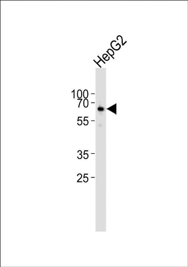 PET112 Antibody in Western Blot (WB)