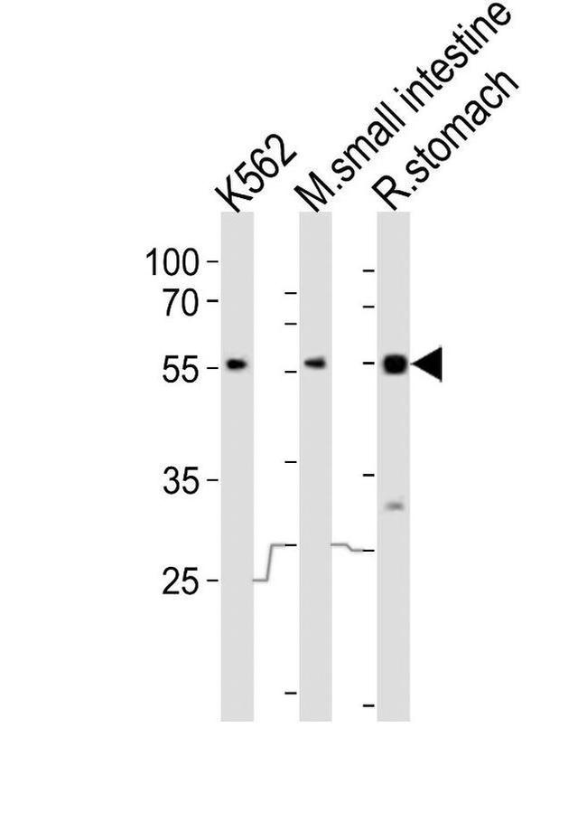 FRK Antibody in Western Blot (WB)