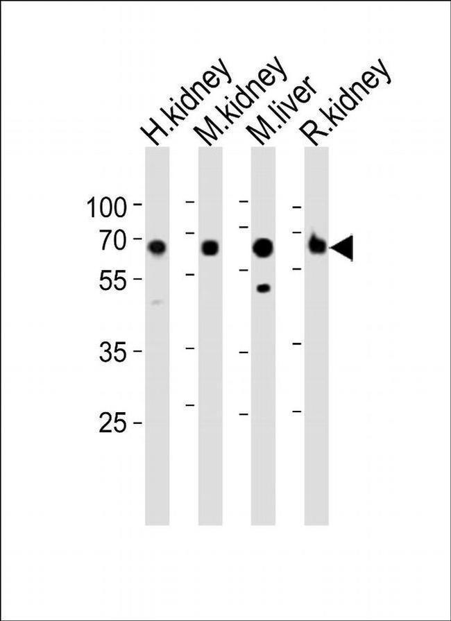 ACSM5 Antibody in Western Blot (WB)