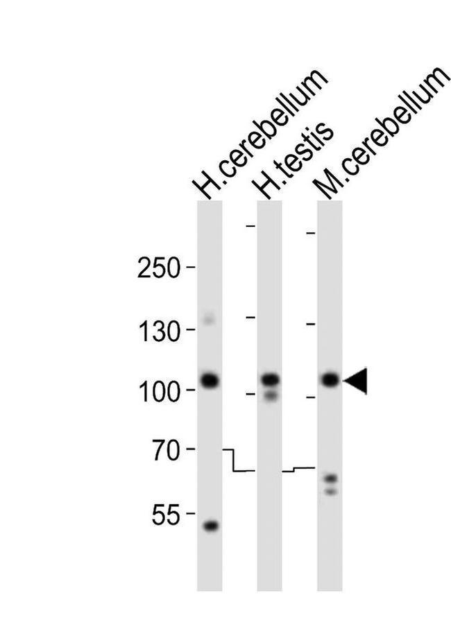 SKOR2 Antibody in Western Blot (WB)