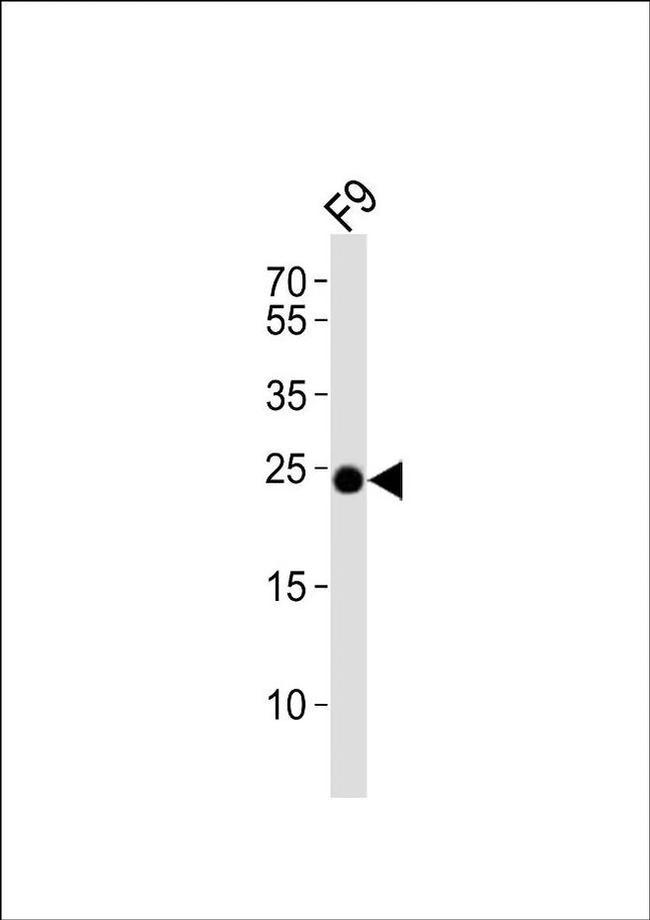 ERAS Antibody in Western Blot (WB)