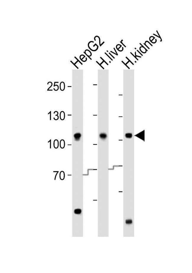 MTTP Antibody in Western Blot (WB)