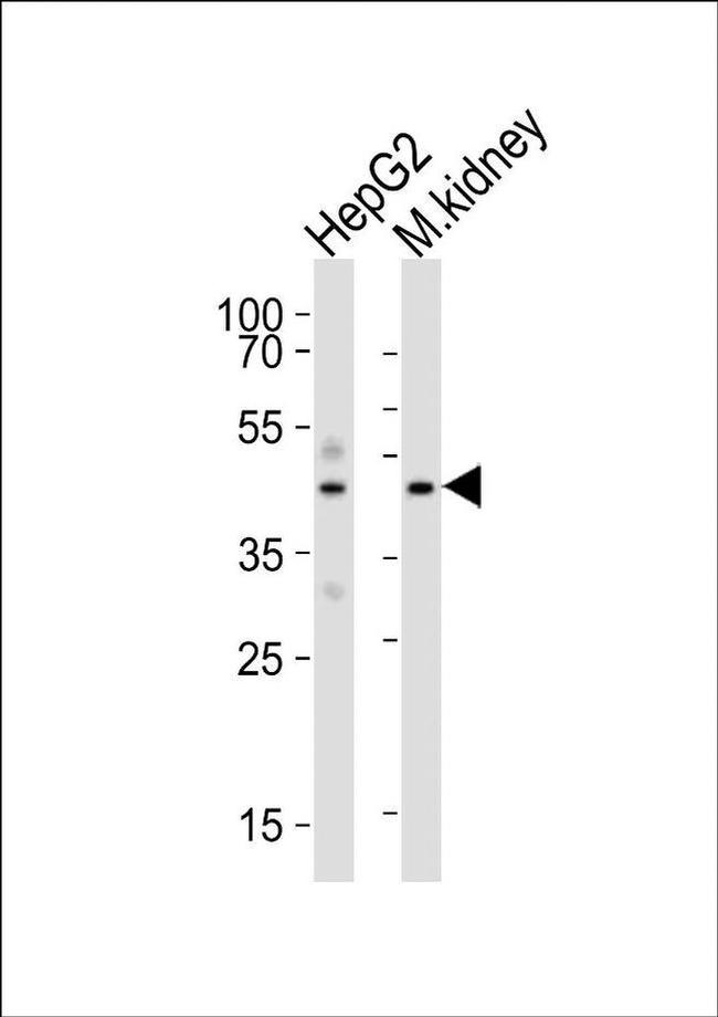 DNase I Antibody in Western Blot (WB)