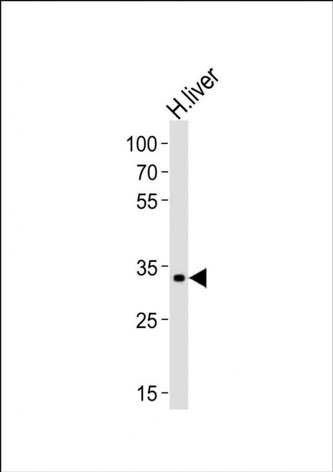LRTOMT Antibody in Western Blot (WB)