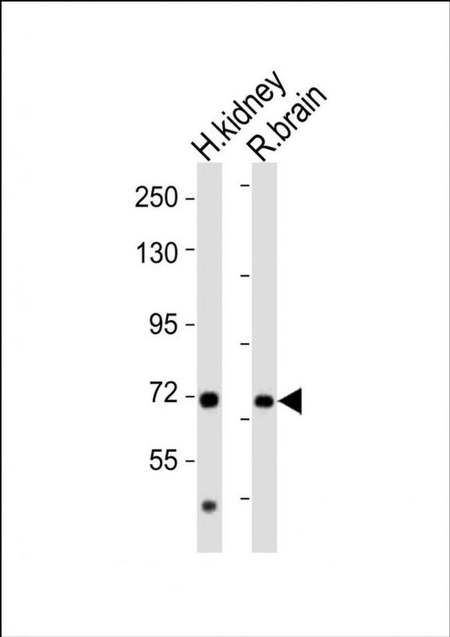 AACS Antibody in Western Blot (WB)