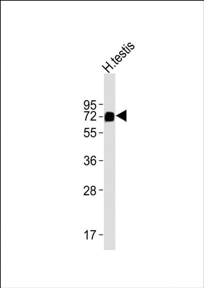 MFSD6L Antibody in Western Blot (WB)