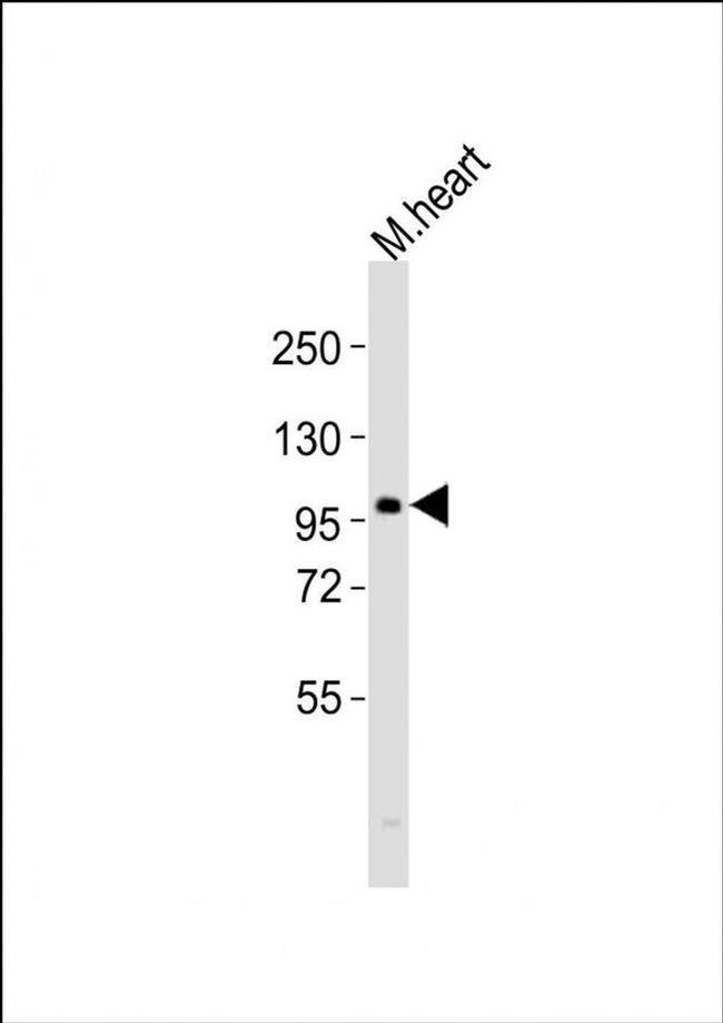 ATG9A Antibody in Western Blot (WB)