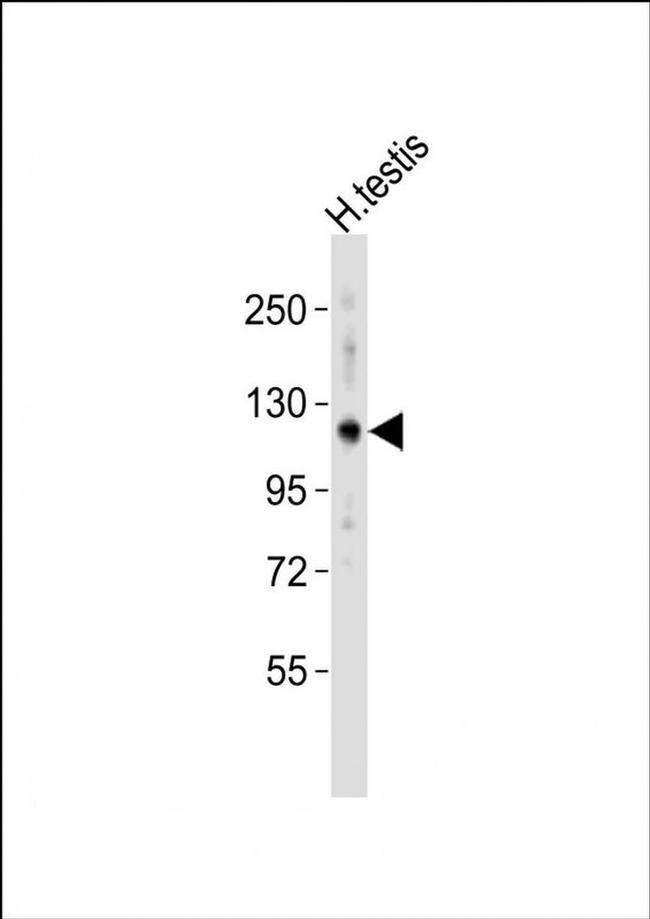 HERC4 Antibody in Western Blot (WB)