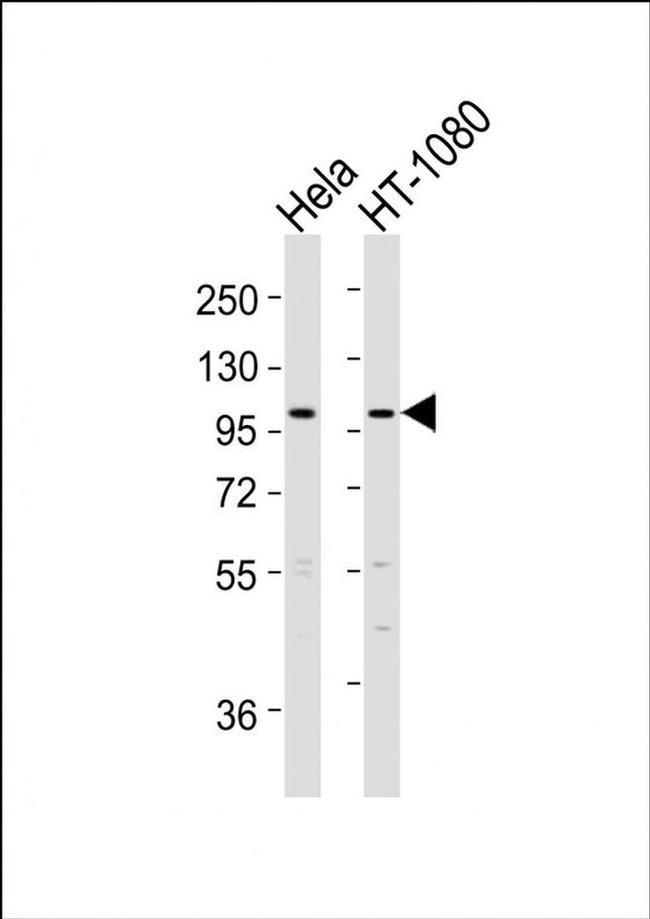 ADAMTS6 Antibody in Western Blot (WB)
