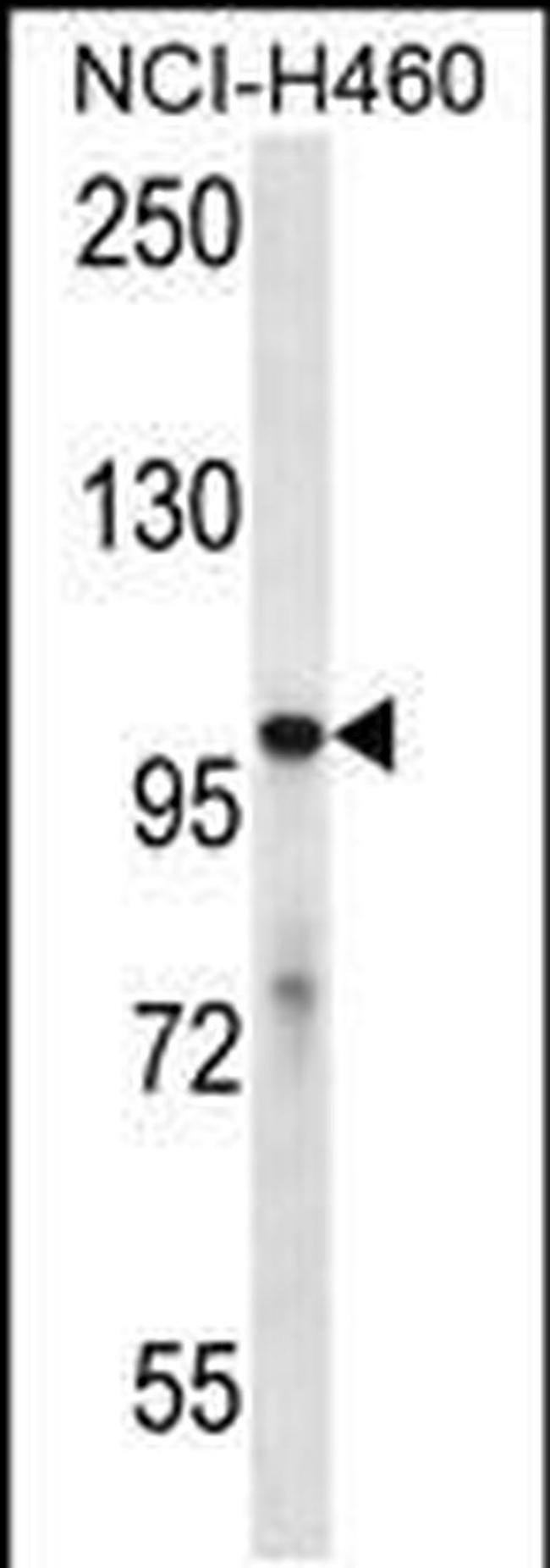 USP6 Antibody in Western Blot (WB)
