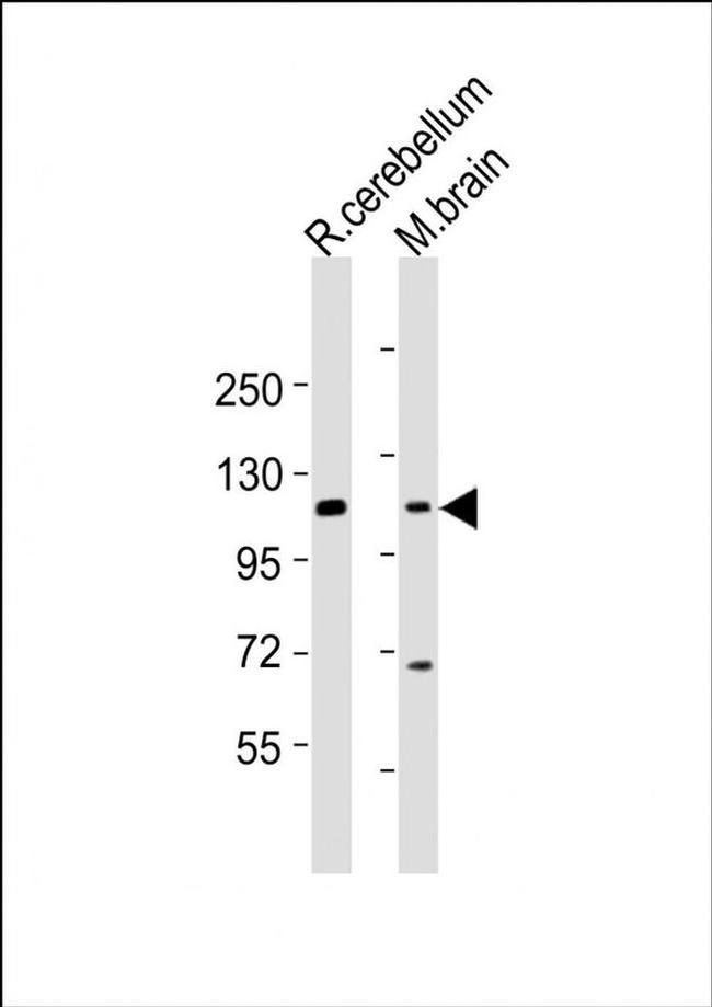 UNC5B Antibody in Western Blot (WB)