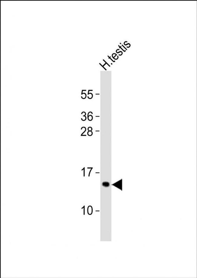 PCP2 Antibody in Western Blot (WB)