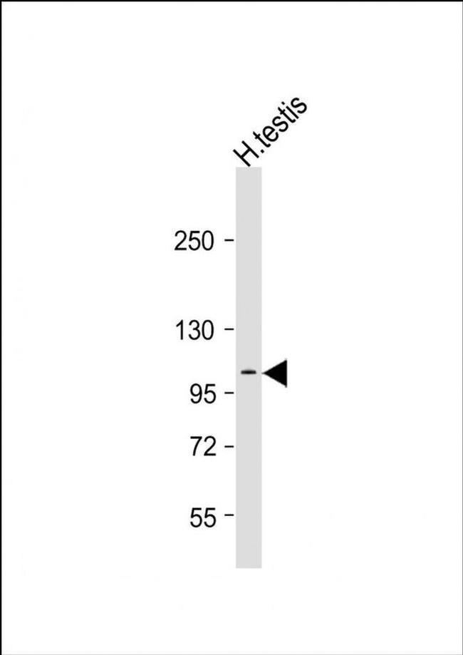 AQPEP Antibody in Western Blot (WB)