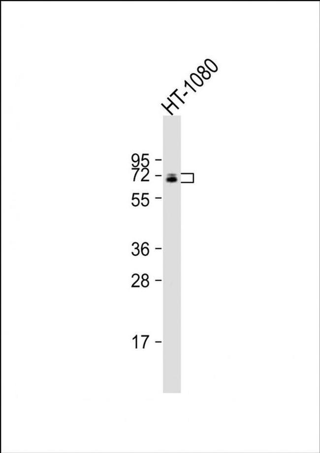 C17orf80 Antibody in Western Blot (WB)
