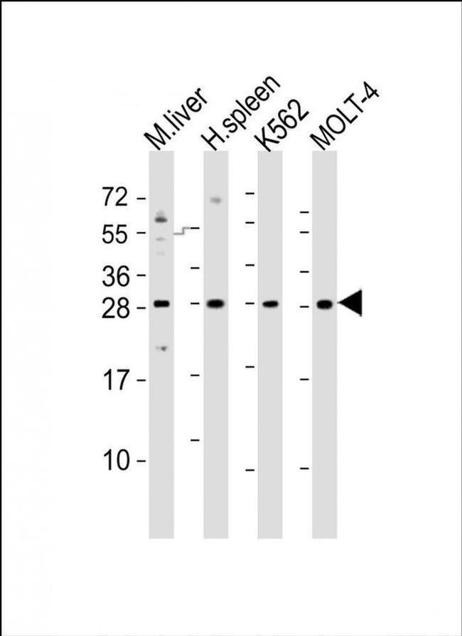 SLA2 Antibody in Western Blot (WB)