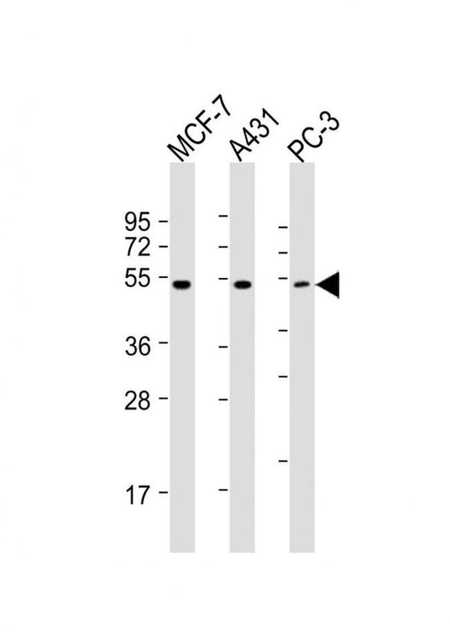 PPP2R5E Antibody in Western Blot (WB)