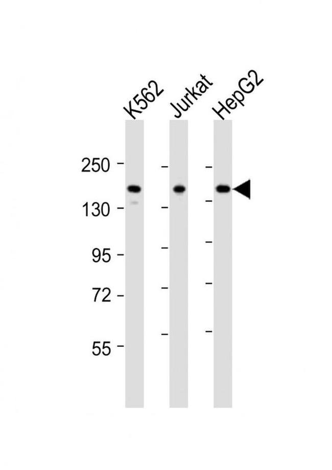 IQSEC2 Antibody in Western Blot (WB)