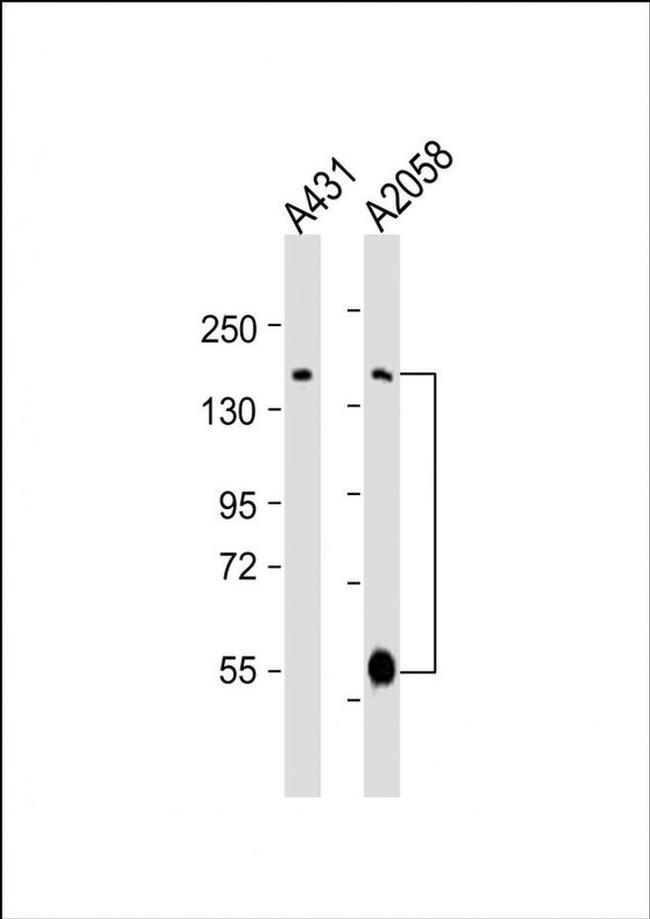 ADAMTS17 Antibody in Western Blot (WB)