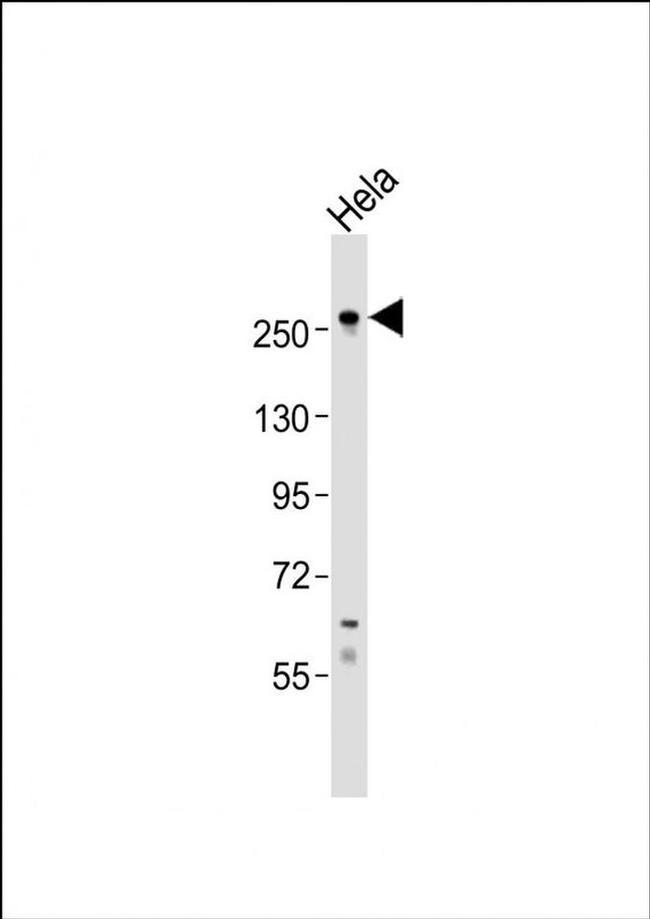 CASC5 Antibody in Western Blot (WB)