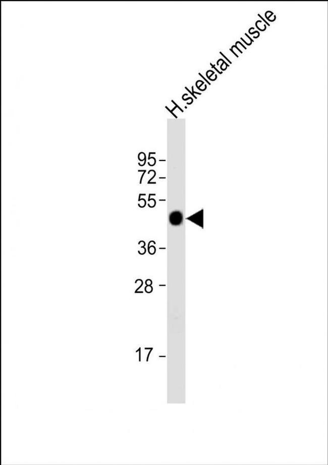 HYKK Antibody in Western Blot (WB)