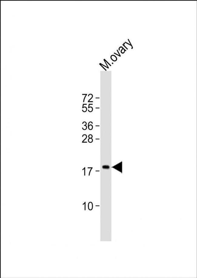 NDUFB7 Antibody in Western Blot (WB)