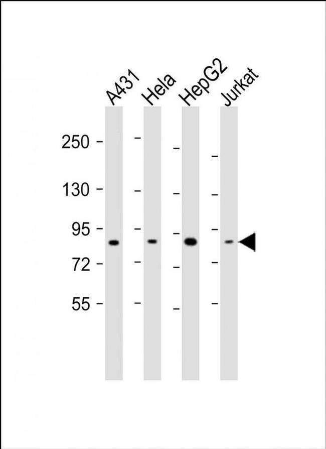 NEK10 Antibody in Western Blot (WB)