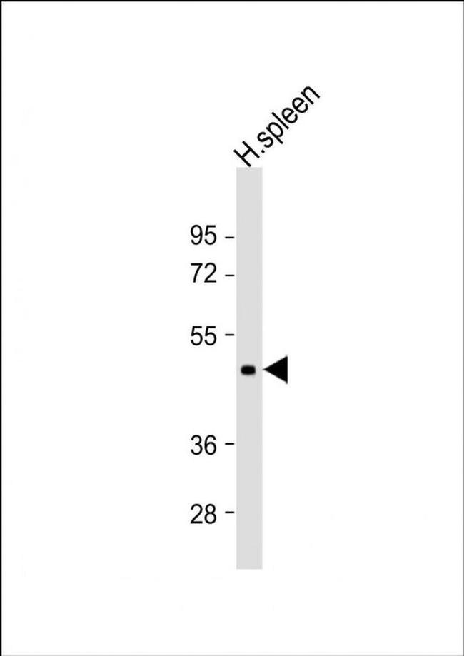 DPEP2 Antibody in Western Blot (WB)