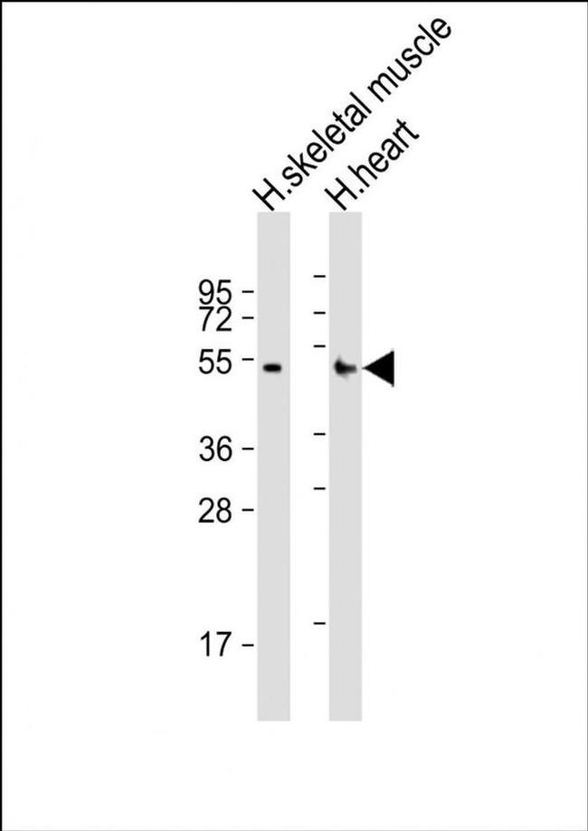 RHBDL1 Antibody in Western Blot (WB)