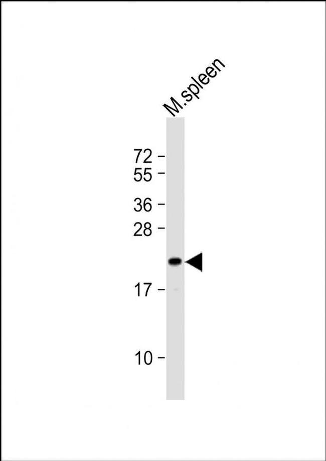 SEC11C Antibody in Western Blot (WB)