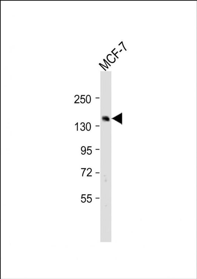 SCAF8 Antibody in Western Blot (WB)
