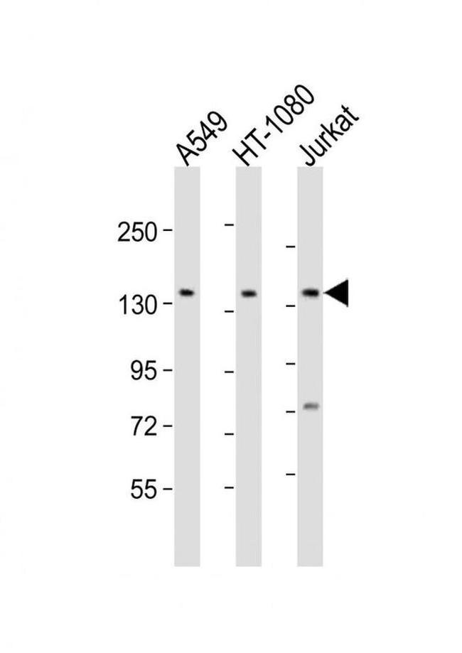 FMN1 Antibody in Western Blot (WB)