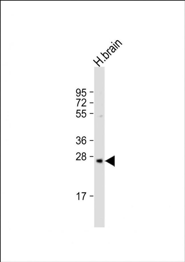 PRSS33 Antibody in Western Blot (WB)