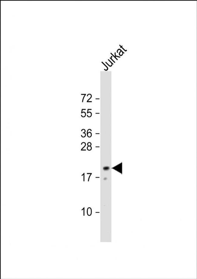 NTS Antibody in Western Blot (WB)