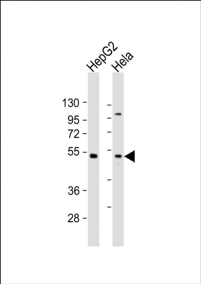 ZFP2 Antibody in Western Blot (WB)