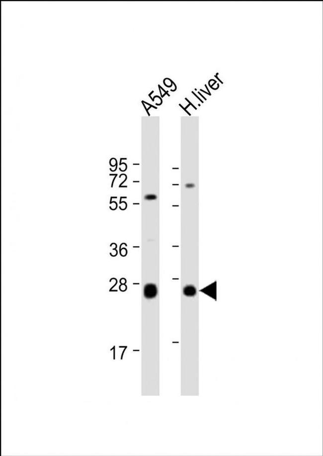 TRH Antibody in Western Blot (WB)