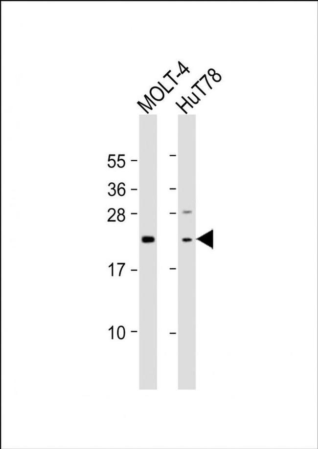 DLEU7 Antibody in Western Blot (WB)
