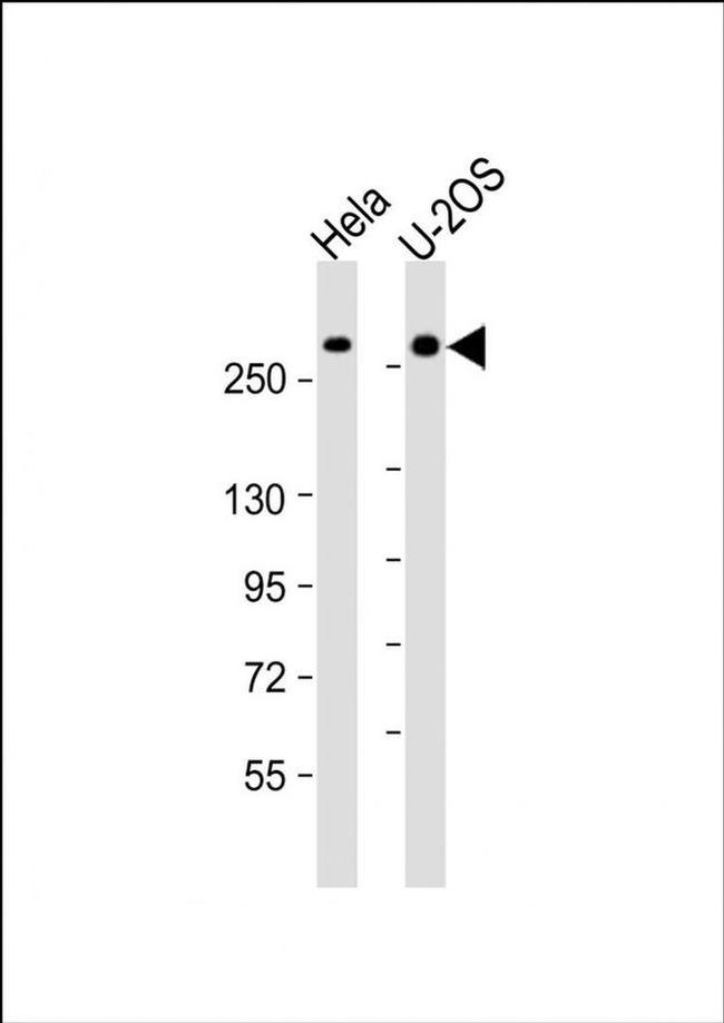 FANCM Antibody in Western Blot (WB)